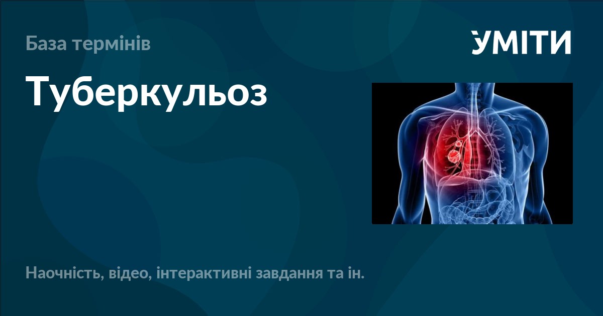 Туберкульоз – УМІТИ